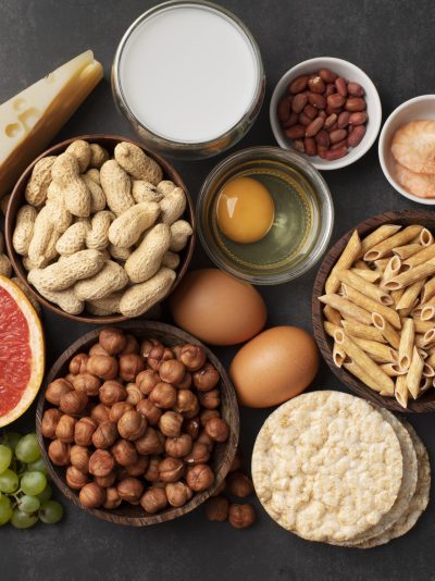Test intolleranze alimentari