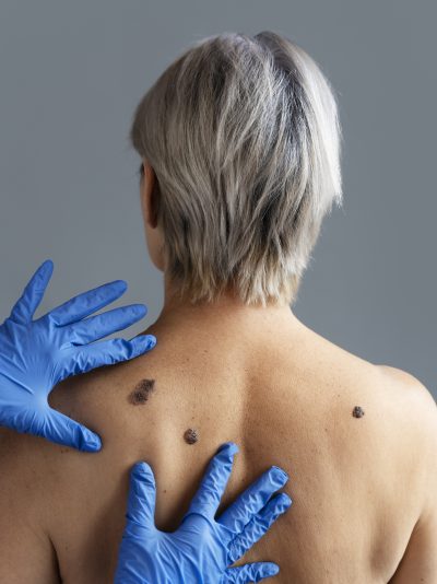 Dermatologia