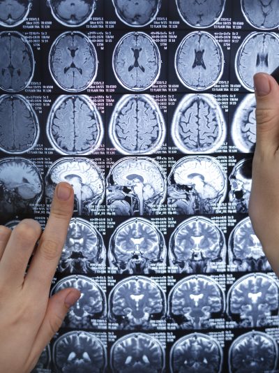 Neurologia controllo