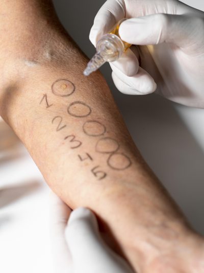 Test Allergologia